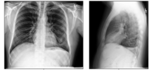chest radiographs